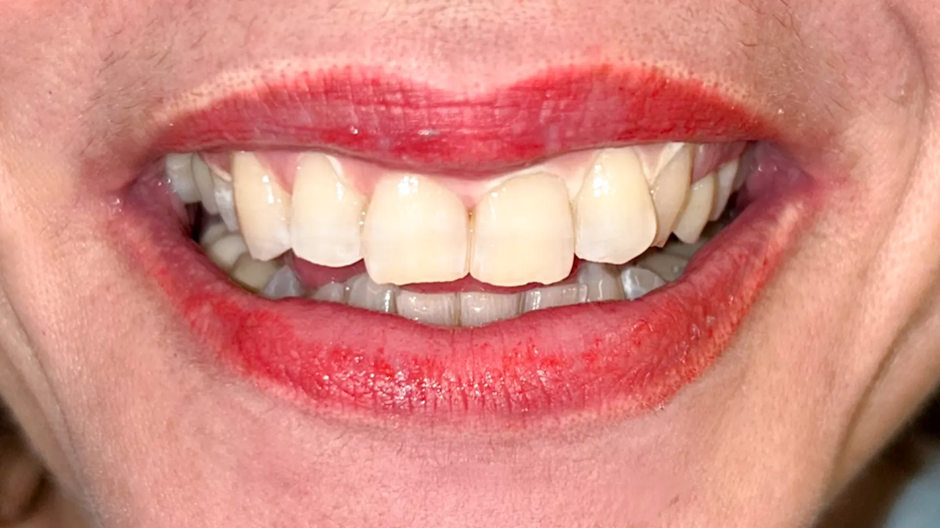 ciro espai dental sonrisas 01