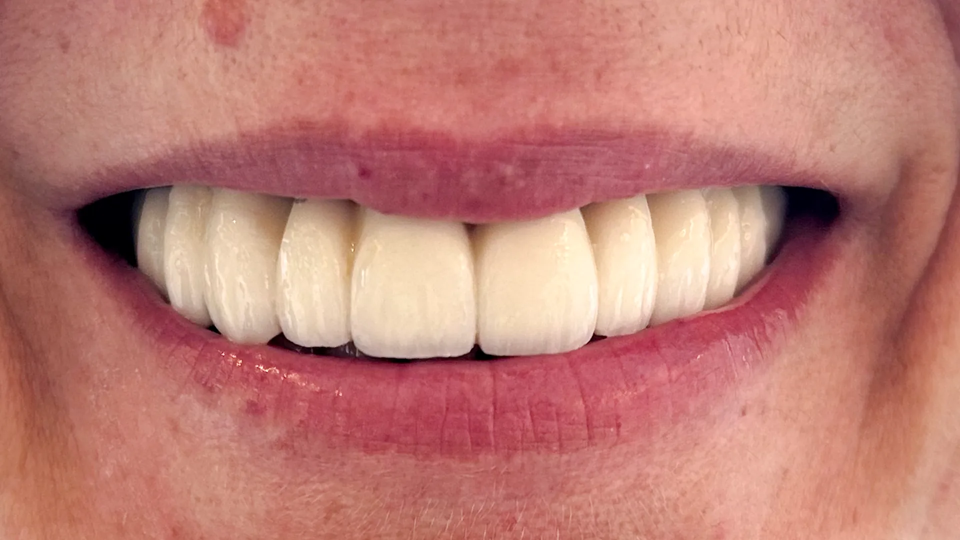 ciro espai dental sonrisas 02