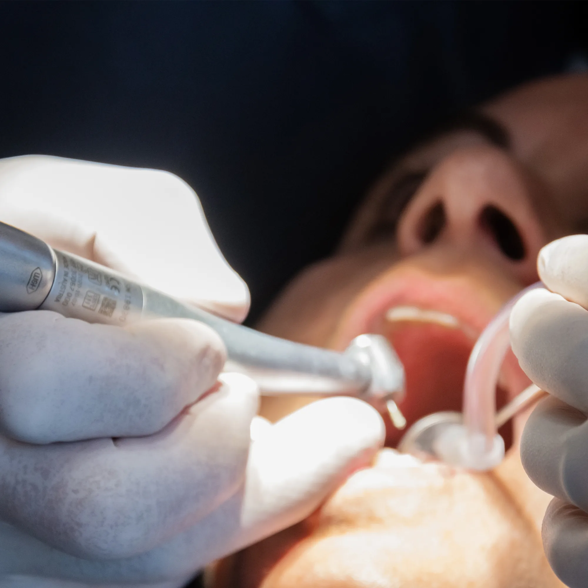 ciro espai dental testimonios