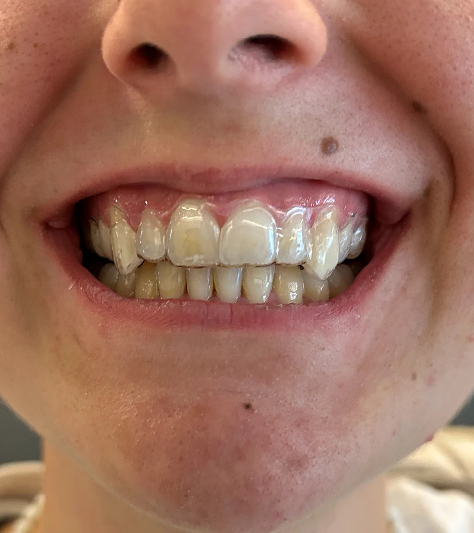 ciro espai dental sonrisas 06