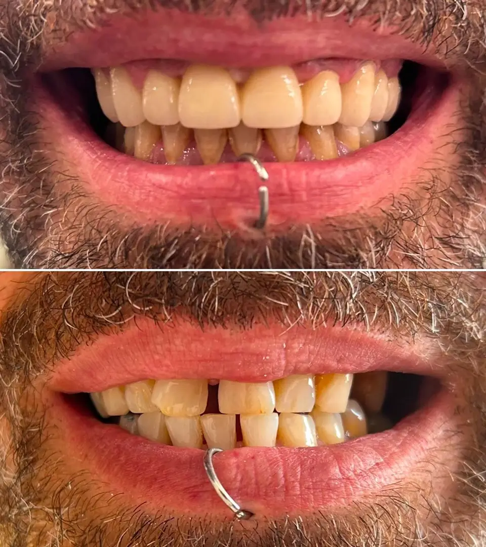 ciro espai dental sonrisas 07