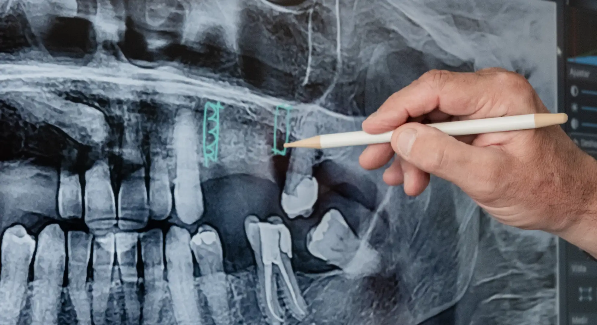 ciro espai dental tratamientos
